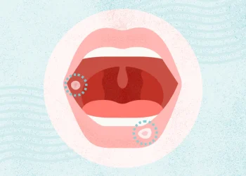 ¿Qué son las lesiones bucales?