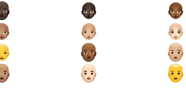 ¿Te estás quedando calvo? Hay una IA para eso