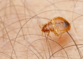 Cómo saber si tienes chinches