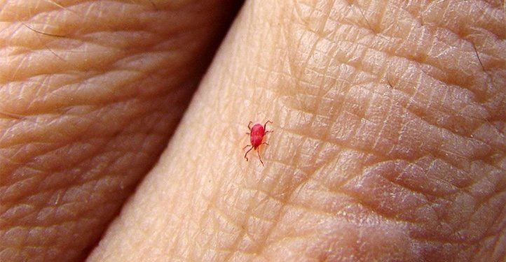 Cómo saber cuándo es una picadura de nigua