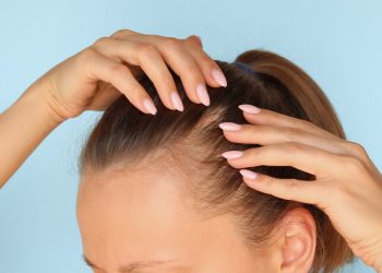 Lo que la puntuación SALT puede (y no puede) decirle sobre la alopecia areata