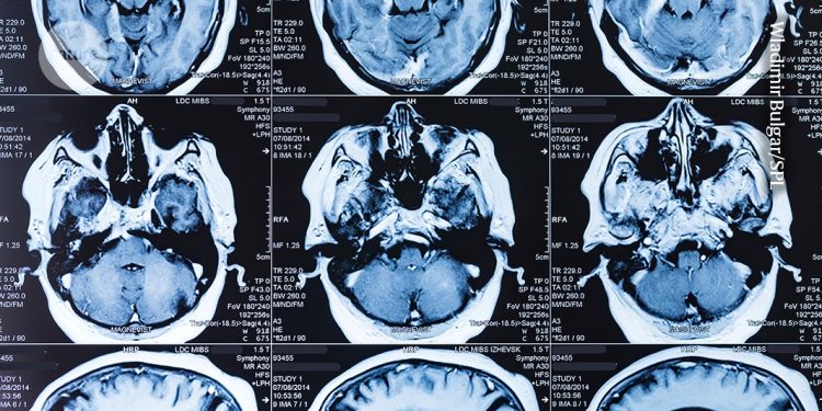 Avances que muestran por qué se debe proteger la investigación fundamental.
