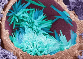 ¿Puede la edición genética prevenir enfermedades cardíacas?