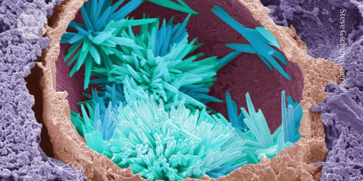 ¿Puede la edición genética prevenir enfermedades cardíacas?