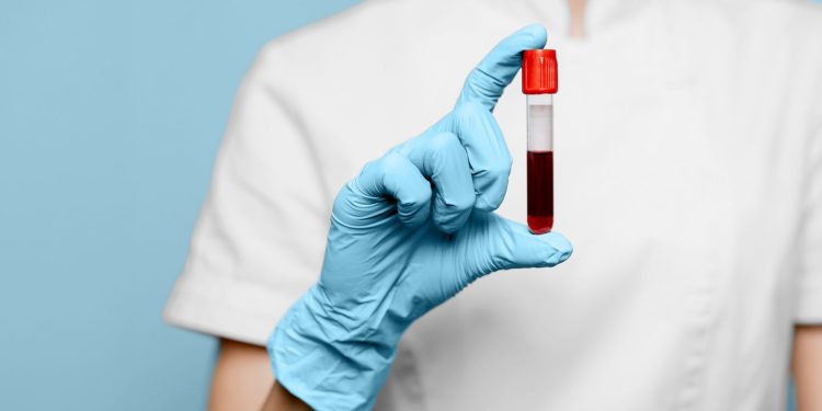 Alimentos que se deben evitar antes de un análisis de sangre