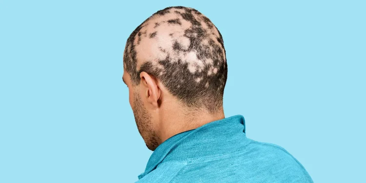 Cómo afrontar la ansiedad y la depresión