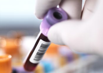 La edición de genes CRISPR funciona para reducir el colesterol alto en un nuevo estudio: NPR