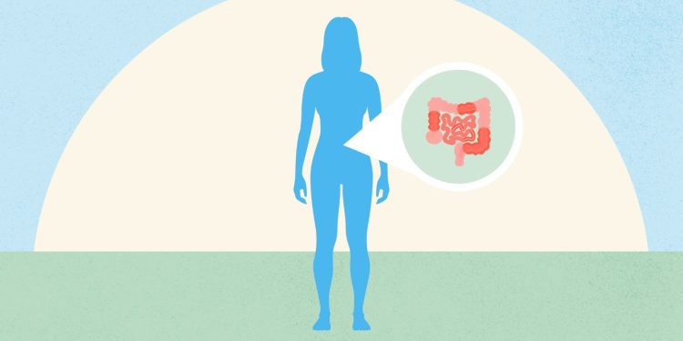 ¿Qué es la 'enfermedad de Crohn silenciosa' y cómo saber si la padece?