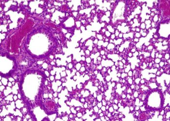 Crea una 'píldora viva' para combatir las infecciones pulmonares resistentes a los antibióticos