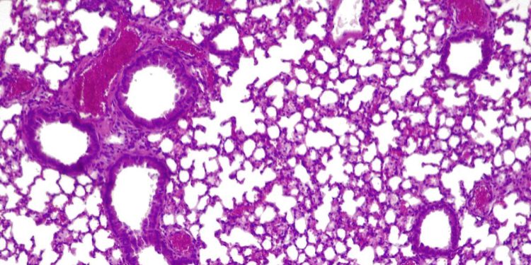 Crea una 'píldora viva' para combatir las infecciones pulmonares resistentes a los antibióticos