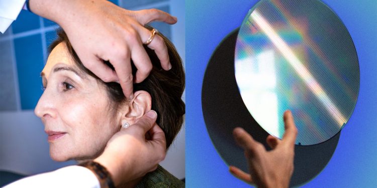 ¿Quiere un audífono Fortell? Bueno, ¿a quién conoces?