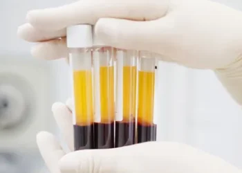 La EMA certifica por primera vez plasma de África y Oriente Medio para su uso en medicamentos en la UE