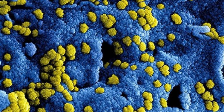 La OMS notifica 19 casos y cuatro muertes por MERS-CoV en el mundo en 2025