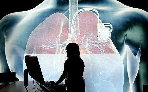 La razón que explica que los infartos sean menos graves por noche