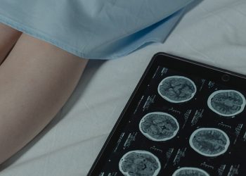 Nuevas claves explican cómo afecta un ictus a la comprensión del habla.