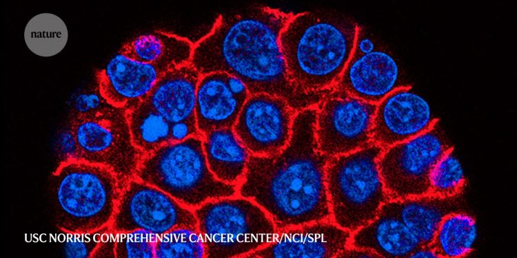 Seis aspectos destacados de la investigación del cáncer de páncreas