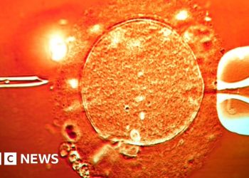 Se utilizó esperma de un donante con un gen cancerígeno para concebir a casi 200 niños