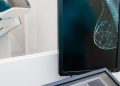 Un nuevo estudio desafía la forma en que detectamos el cáncer de mama