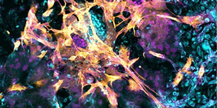 Los científicos aprenden más sobre cómo se implantan embriones humanos utilizando úteros artificiales: NPR