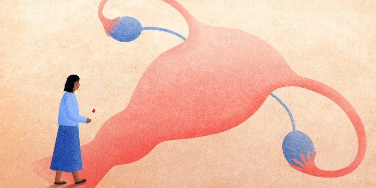 ¿Es la prueba del VPH una alternativa segura y eficaz a la prueba de Papanicolaou? : NPR