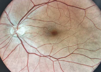 Descubren un fármaco que protege la retina frente a una de las principales causas de ceguera: "Podría trasladarse a pacientes en algunos años"