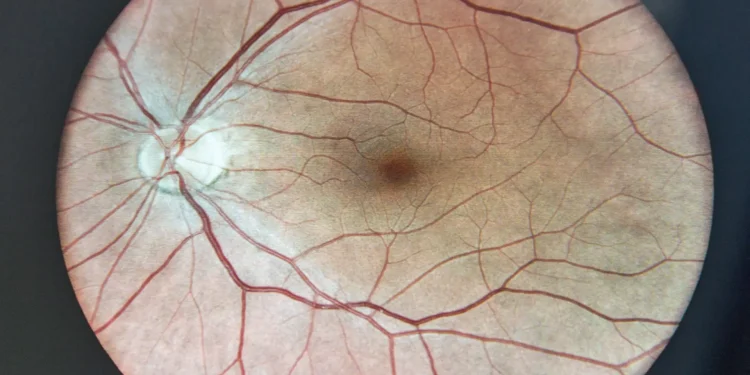 Descubren un fármaco que protege la retina frente a una de las principales causas de ceguera: "Podría trasladarse a pacientes en algunos años"
