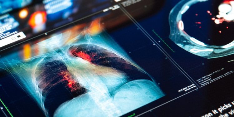 las células 'hablan' entre sí y causan rechazo